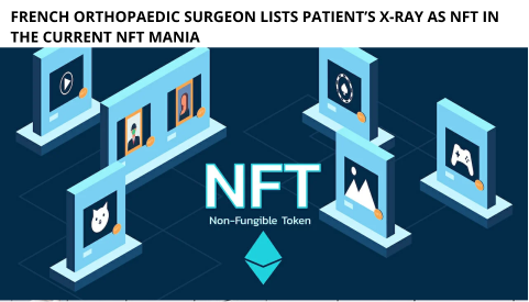 French Orthopaedic Surgeon Lists Patient’s X-Ray As Nft In The Current Nft Mania