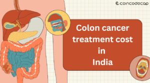 colon cancer treatment cost