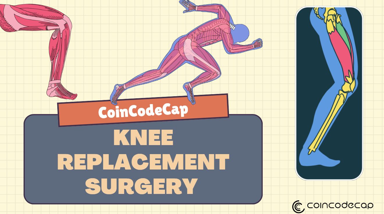 Knee Replacement Surgery Cost